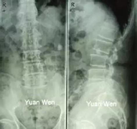 牙科硬膜材的神奇调制：揭秘牙科修复的“秘密武器”(图1)