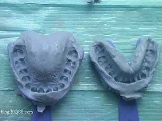 印膜材做假牙：揭秘假牙市场新趋势，如何辨别真伪？(图1)